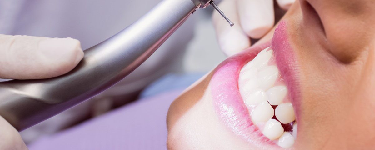 Is it OK to Delay My Dental Filling