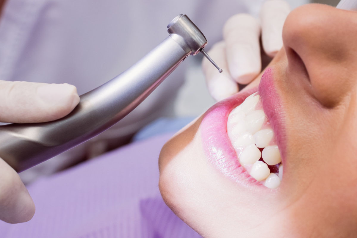 Is it OK to Delay My Dental Filling