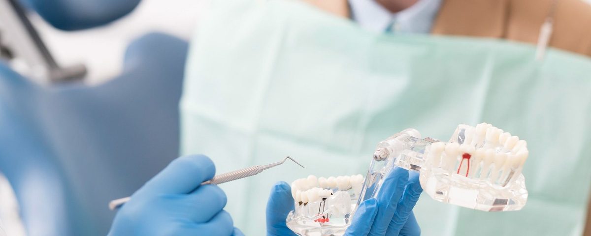 What Is a Post and Core For Teeth Restoration