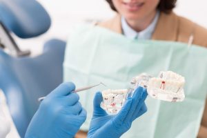 What Is a Post and Core For Teeth Restoration