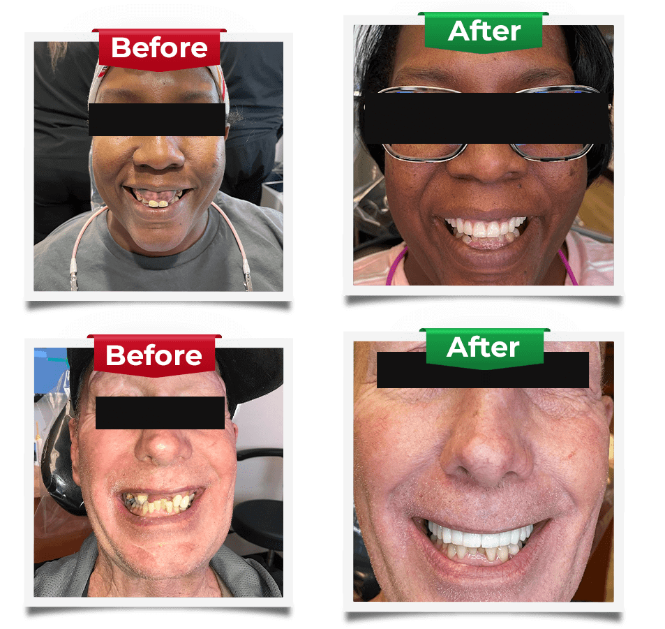 Dental Implants Slider