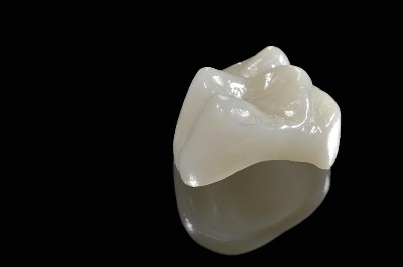 Porcelain Crowns in Phoenix