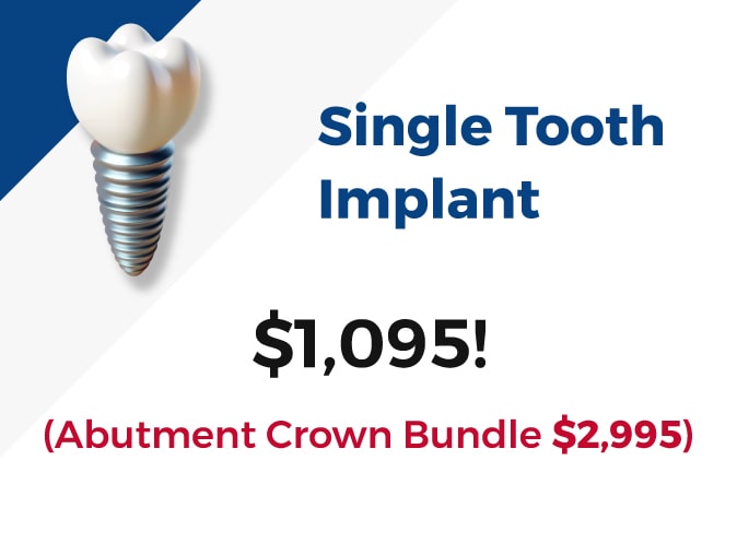 Single Tooth Implant