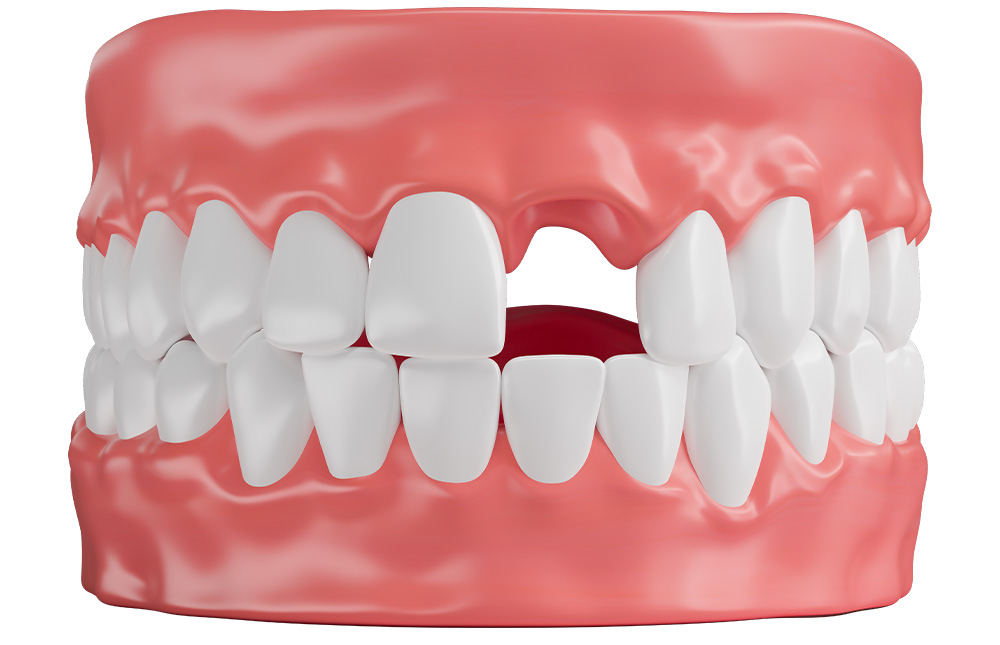 Why Choose Emergency Dental Care