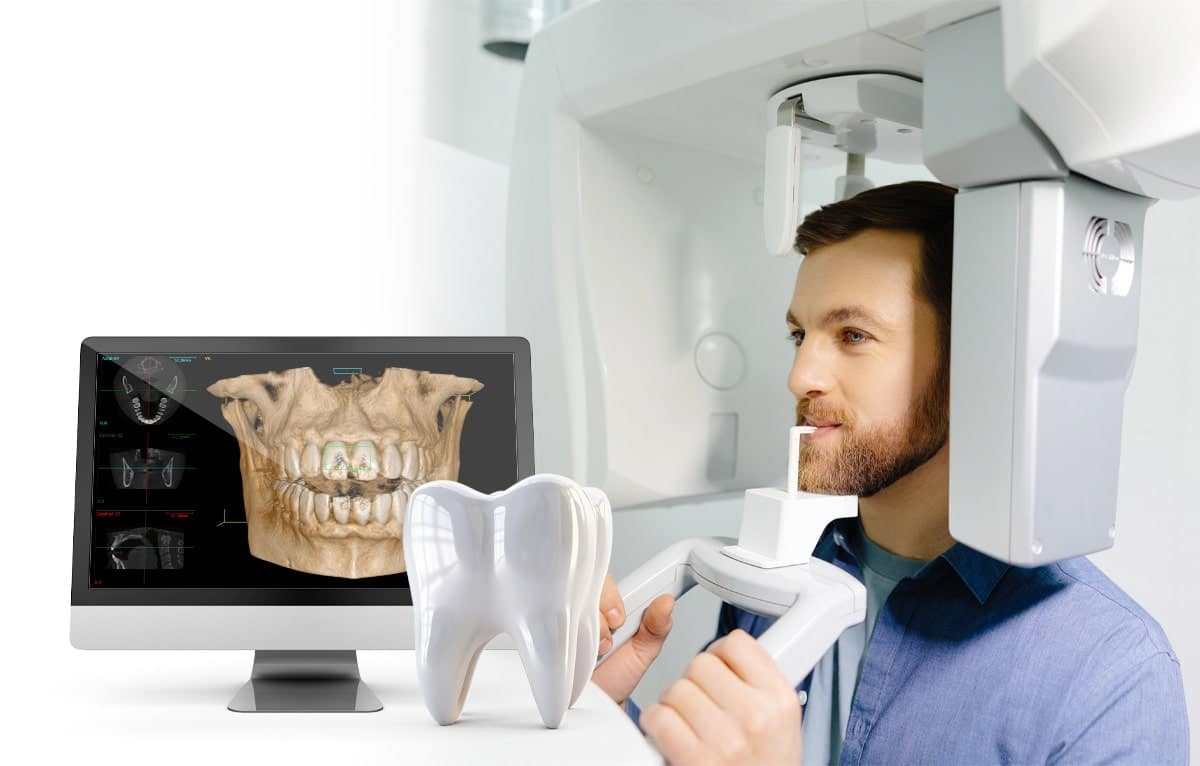 Xray-photo