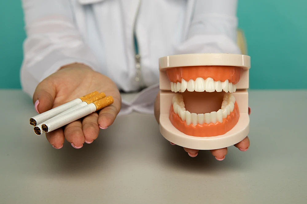 How Long After Fillings Can You Smoke?