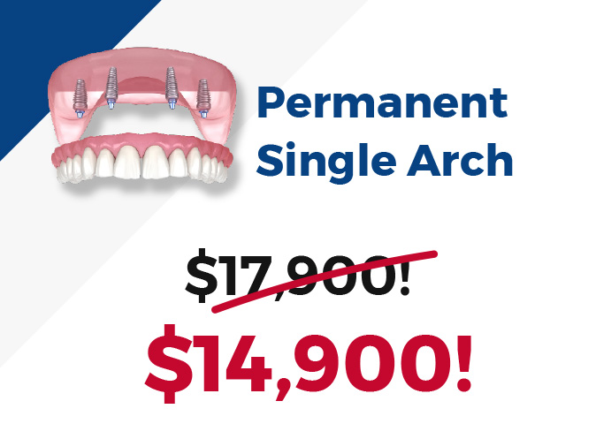 Permanent Single Arch