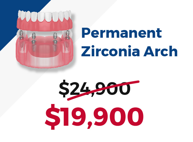 Permanent Zirconia Arch