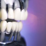 How Long Does a Tooth Implant Take to Heal