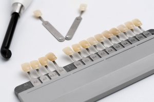 Dental Bonding vs. Veneers What Are the Differences?