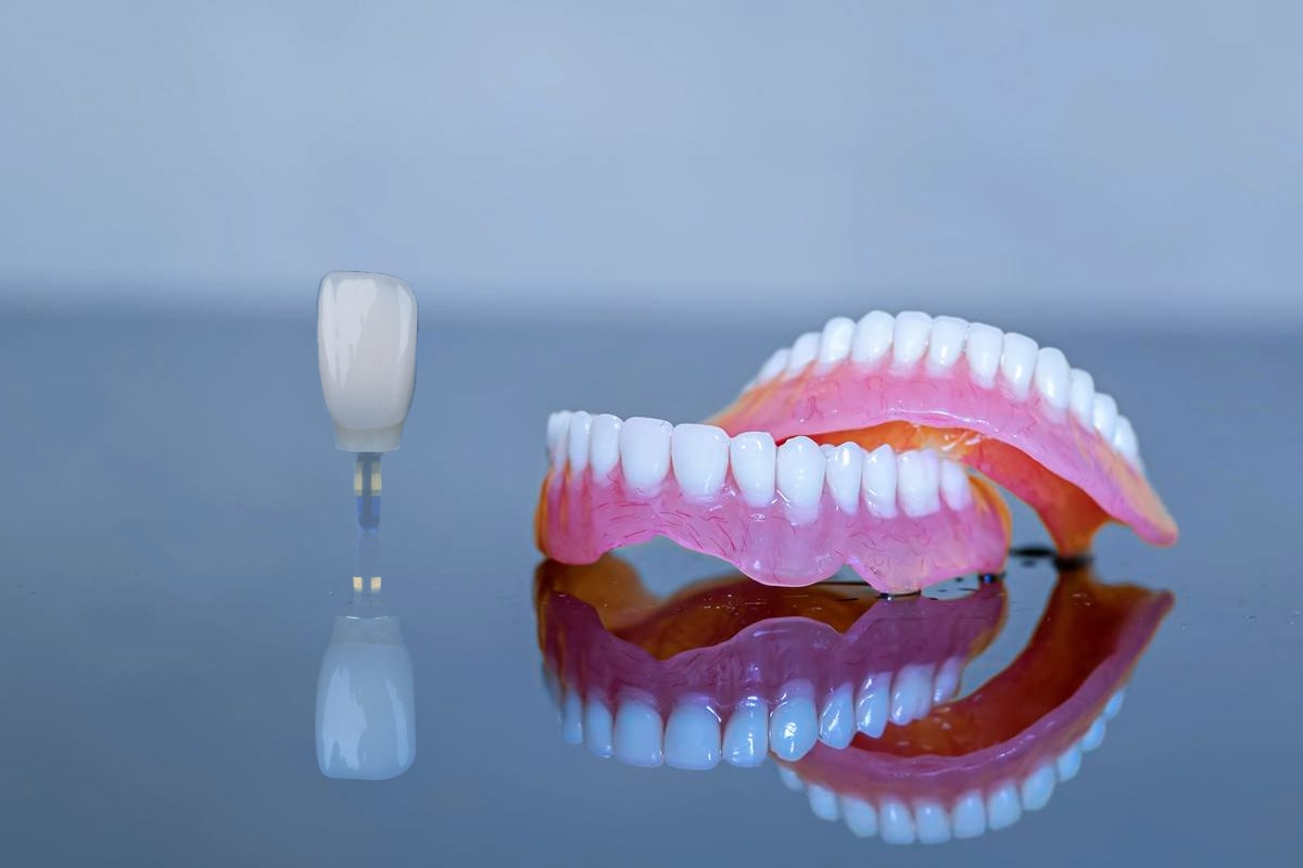 Dental Implants vs Dentures: The Differences