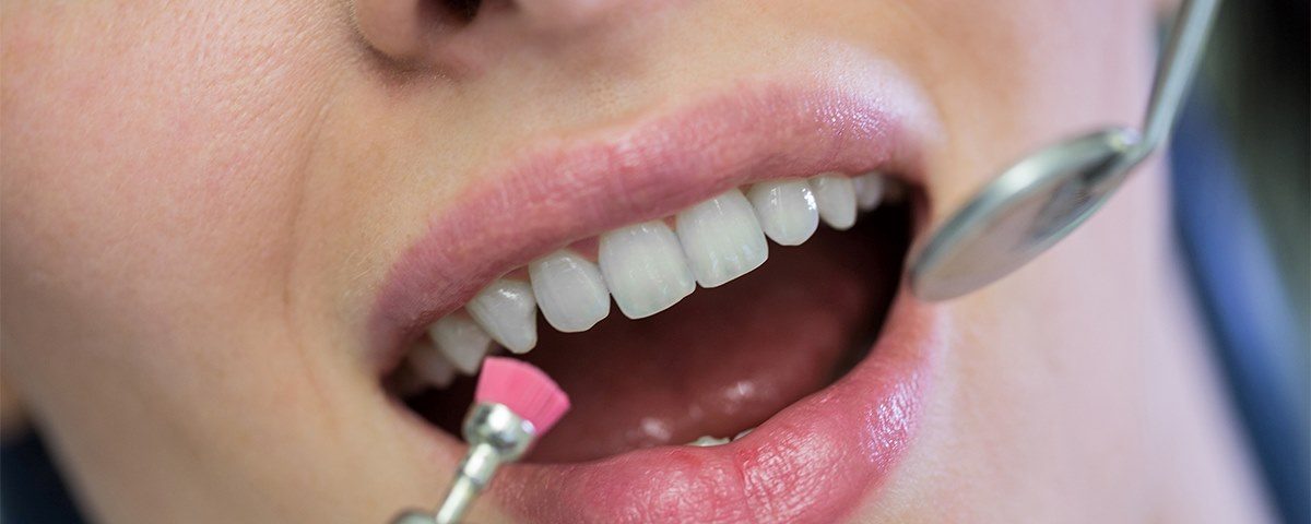 Is a CEREC-Fired Crown Better Than Porcelain?