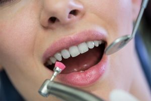 What Are CEREC Crowns Made of?