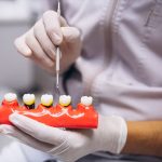7 Differences Between a Dental Implant and a Crown