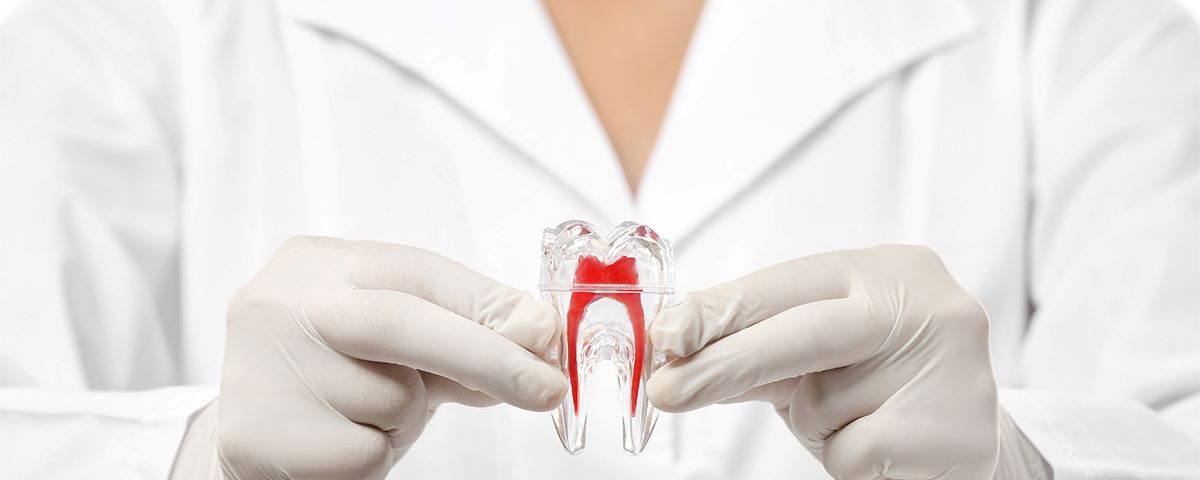 How Do You Know If a Root Canal Failed?