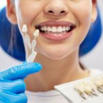 Porcelain Veneers vs Composite Veneers: The Differences