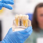 5 Differences Between One-Day Dental Implants and Traditional Implants