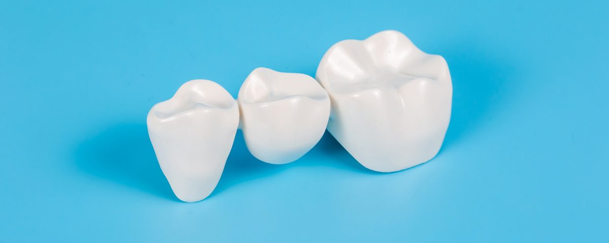 What Are The Differences Between Zirconia And Porcelain Crowns?