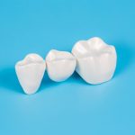 What Are The Differences Between Zirconia And Porcelain Crowns?