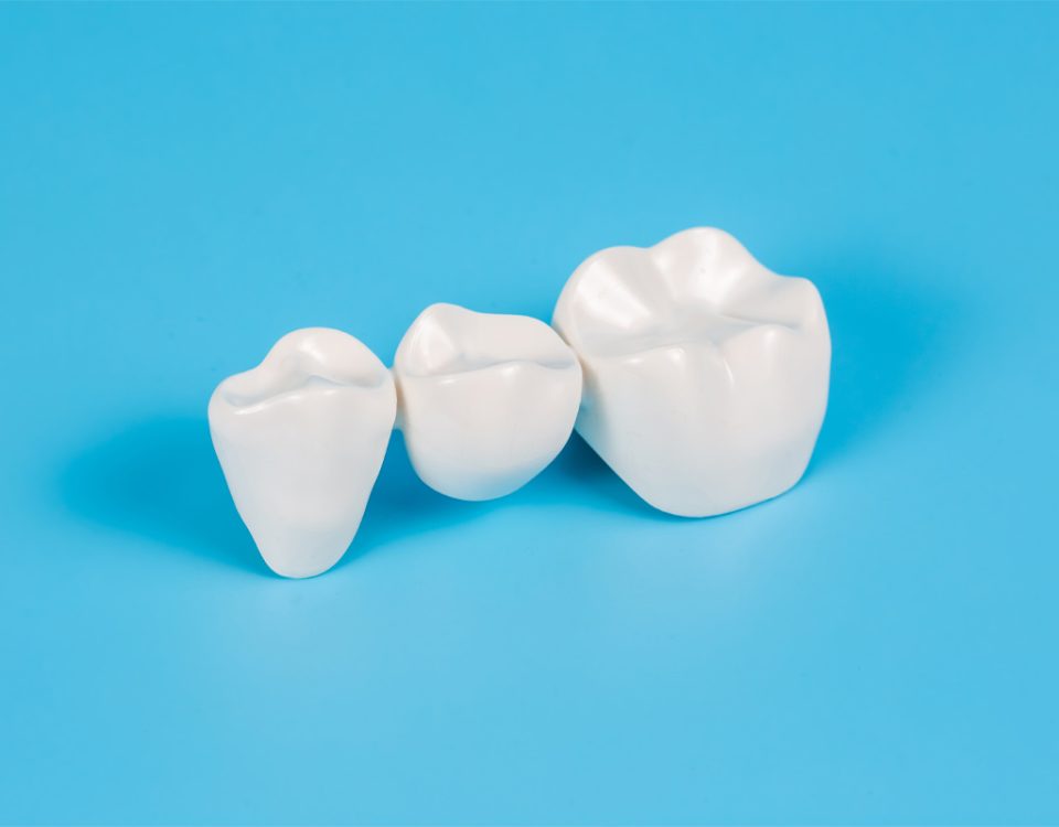 What Are The Differences Between Zirconia And Porcelain Crowns?