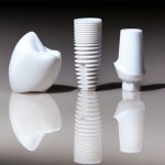 What Are the Differences Between Titanium and Ceramic Implants?