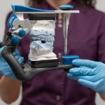 Understanding All-on-X Dental Implants
