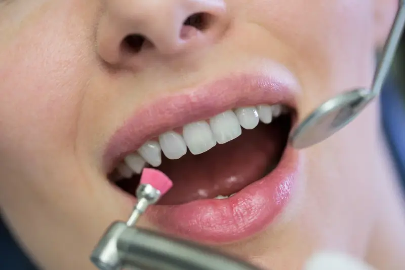 Dental Cleanings and Examinations Near Me in Phoenix