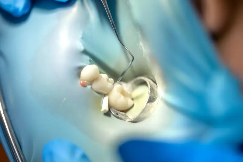 Root Canal Phoenix AZ
