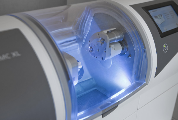 Same Day CEREC Crowns Gilbert, AZ