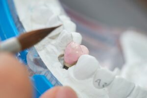 Dental Inlays and Onlays Cost in Phoenix, AZ