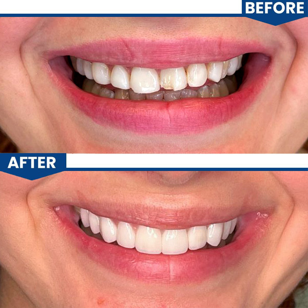 Central Valley Dentistry Gallery