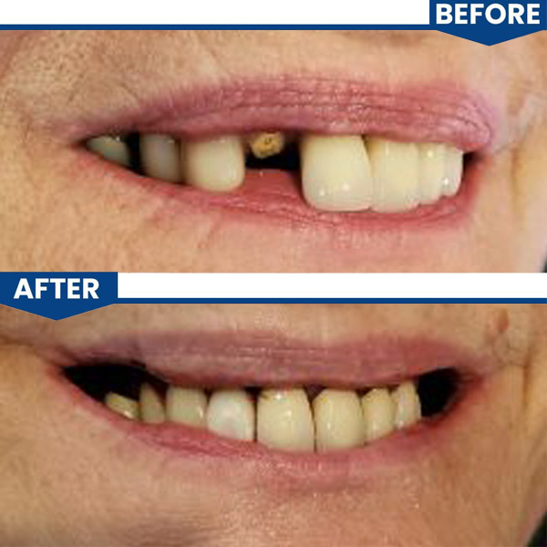 Central Valley Dentistry Gallery