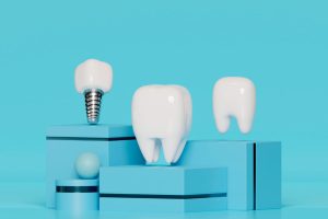 Advanced New Techniques for Implant in 2026