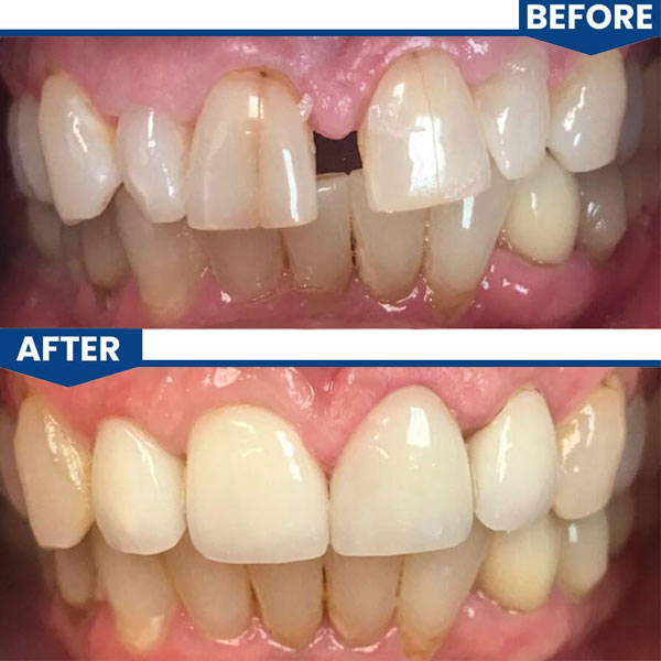 Central Valley Dentistry Gallery