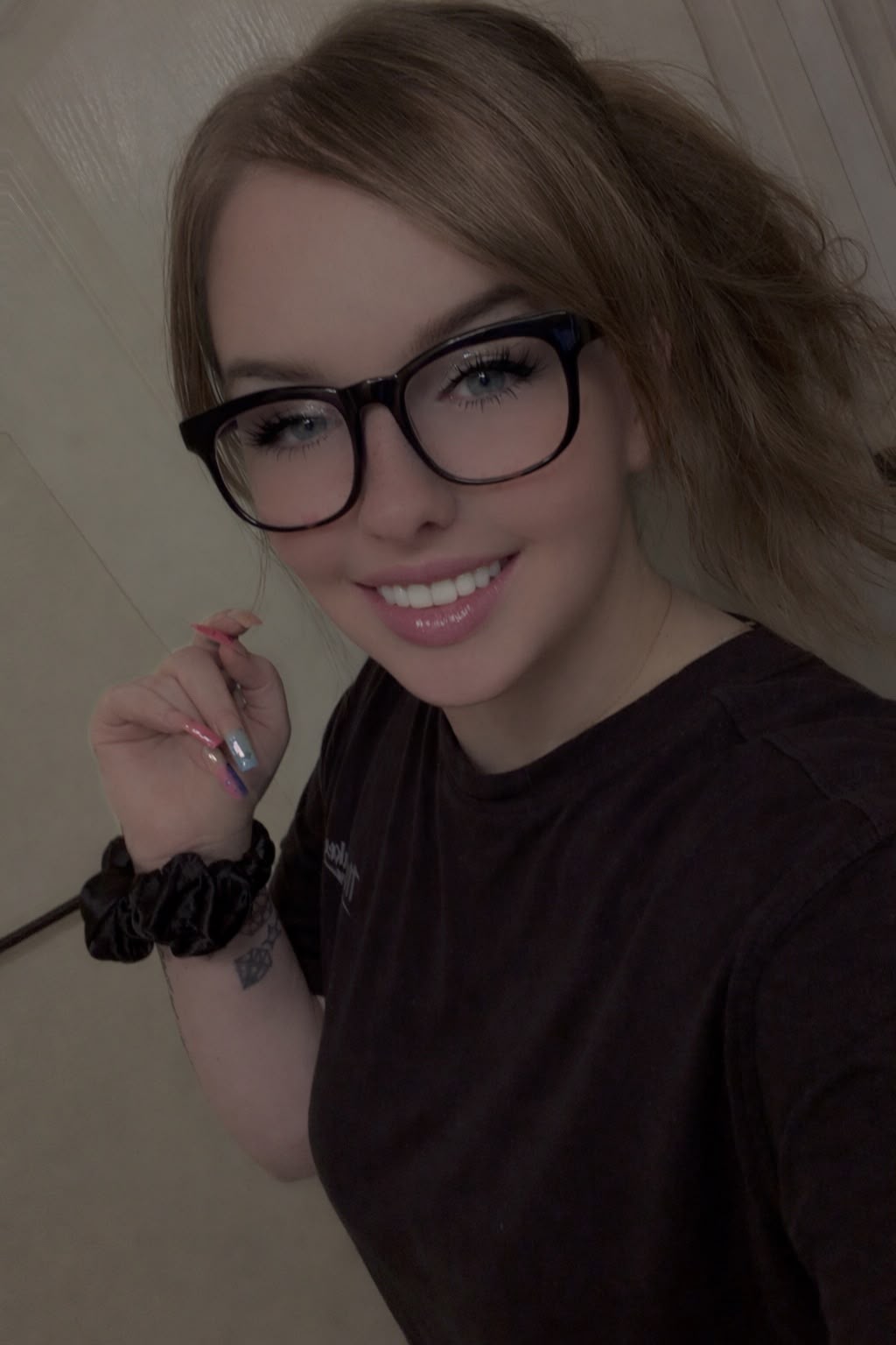 Patient smiling after treatment
