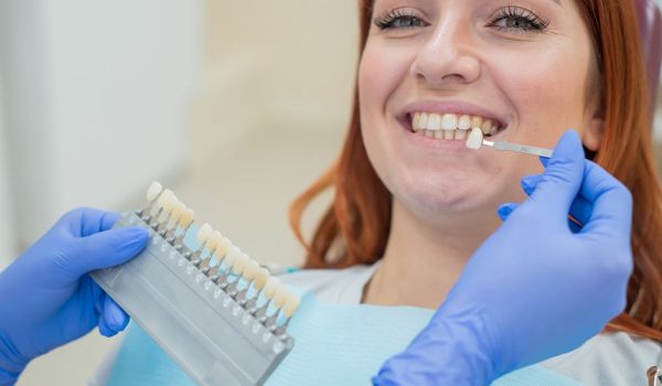 Dental Veneers Dental Veneers